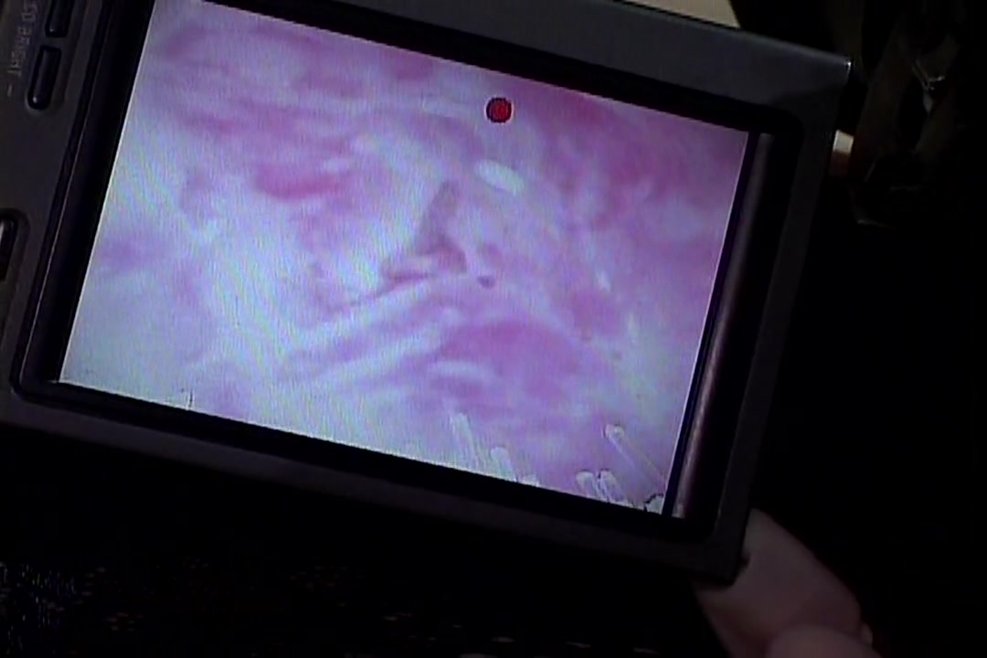 TOKYO CUM SHOT INSIDE PUSSY SCOPE 1 ミュウ/りん/椎名ひとみ サンプル画像