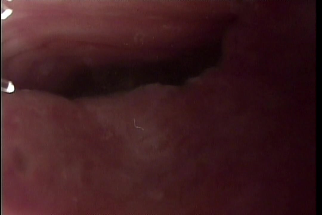 TOKYO CUM SHOT INSIDE PUSSY SCOPE 1 ミュウ/りん/椎名ひとみ サンプル画像