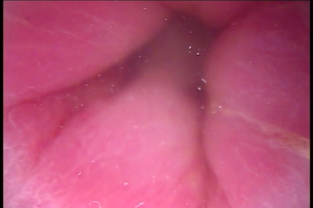 SQUIRT ANAL ADVENTURES -スカート・アナル・アドベンチャーズ-：月咲舞　山咲さくら サンプル画像14