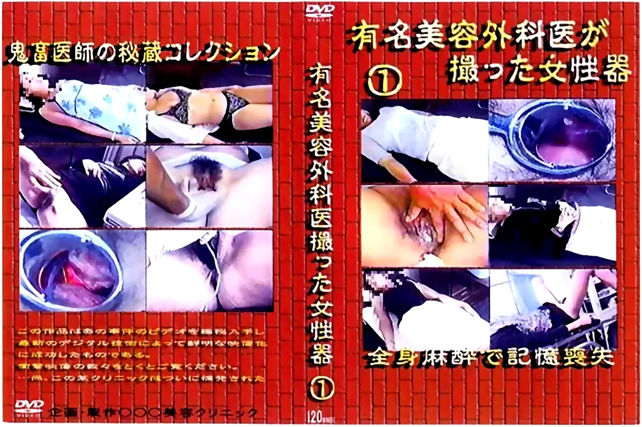 有名美容外科医が撮った女性器 1 - 無料エロ動画付き（サンプル動画）