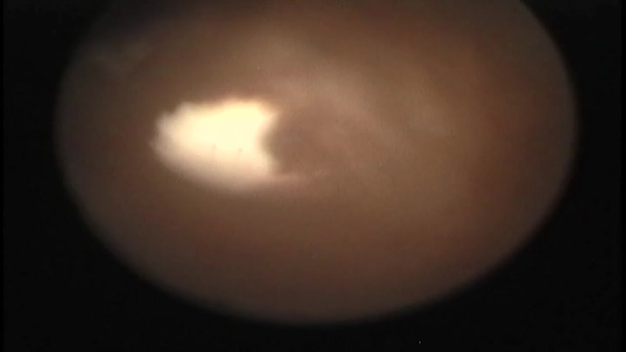ロケットオッパイ、モジャモジャの奥に薄っすらとスジが!No.27 サンプル画像