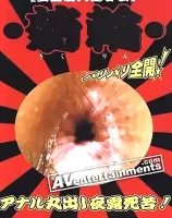 Full View of an Anus Vol.3 (菊輪 3)