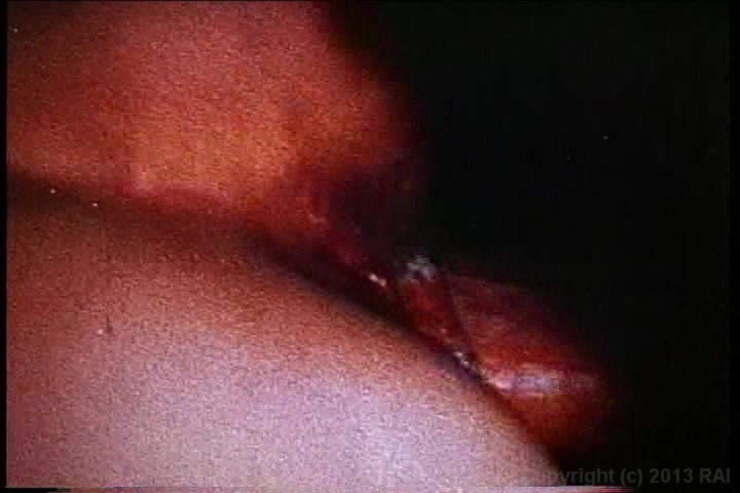 XXX Bra Busters In the 70's 2 サンプル画像28