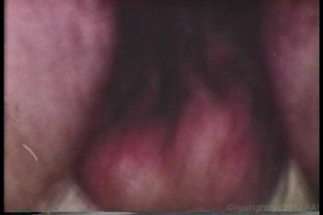Teenage Anal Eruptions サンプル画像63