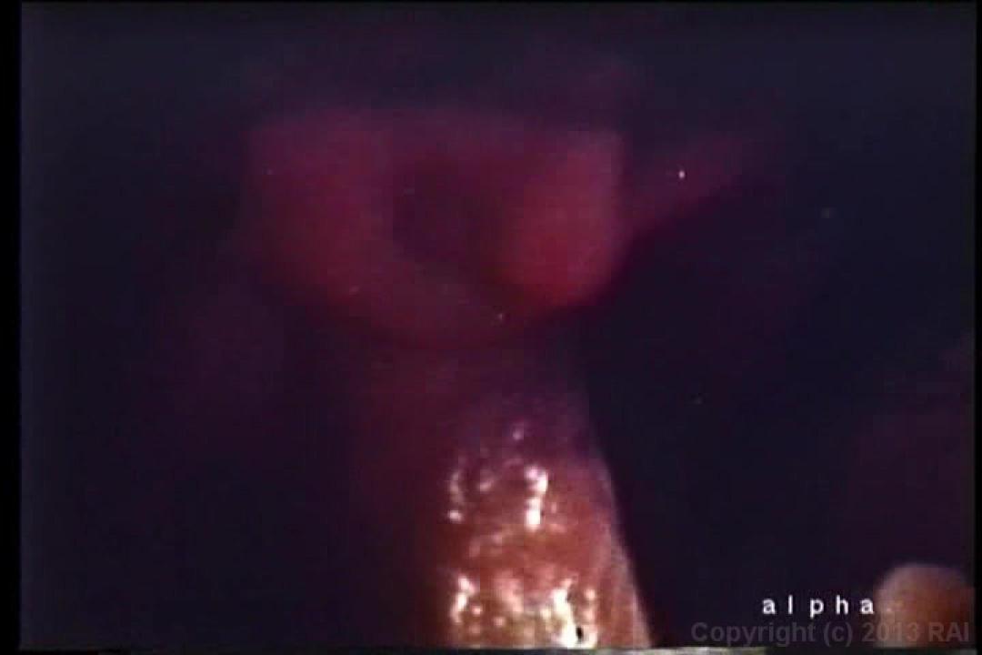 Anal Assault 1 サンプル画像